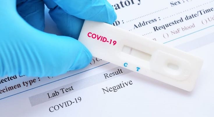 Read more about the article Teste rápido para COVID-19 no Centro Médico Fazendinha – SS Saúde